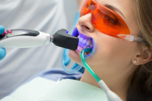 10 Eρωτήσεις για το Οδοντιατρικό Laser